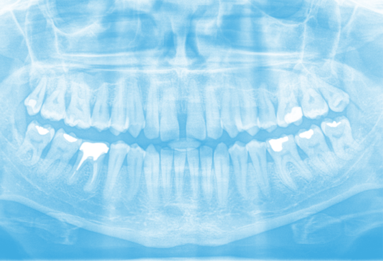 Pantomogram Białystok, niezbędny w chirurgii stomatologicznej